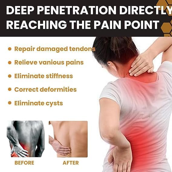 Bee Venom - Joint Soothing Gel